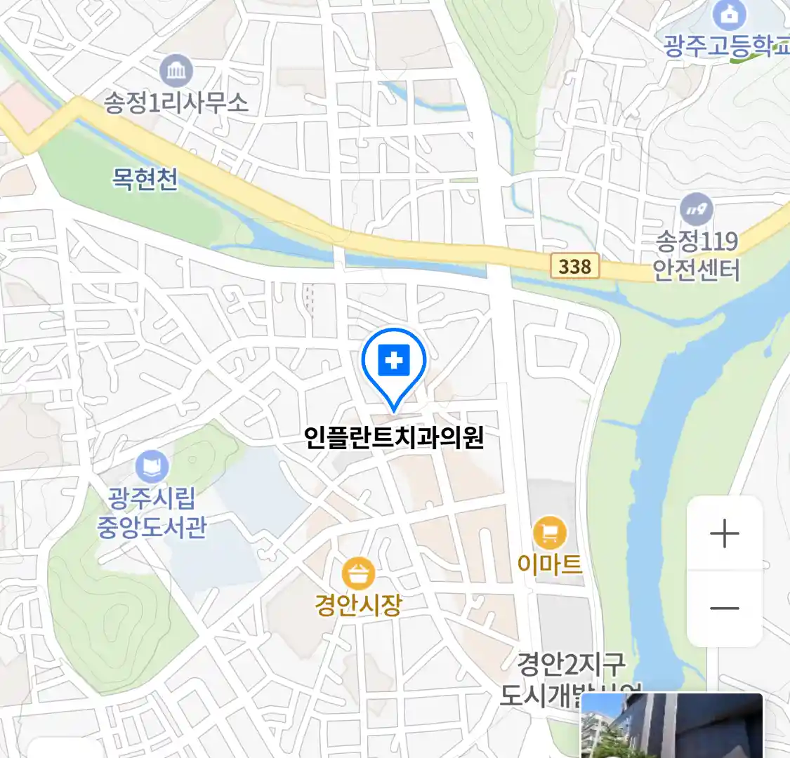 인플란트치과의원 위치