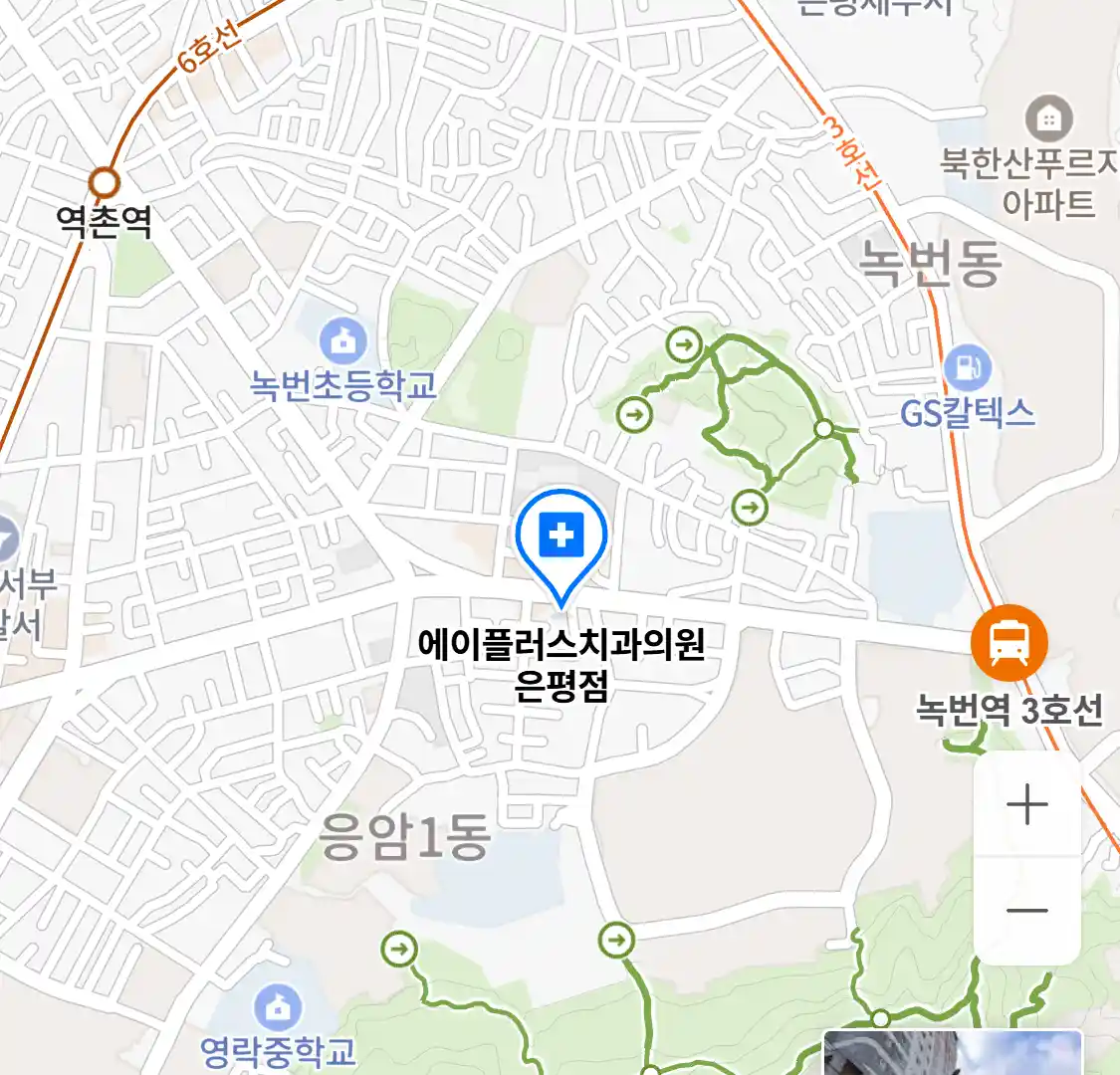 에이플러스치과의원 은평점 위치