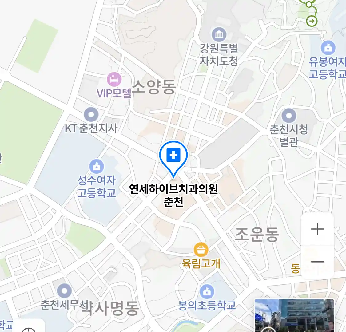 연세하이브치과의원 춘천 위치