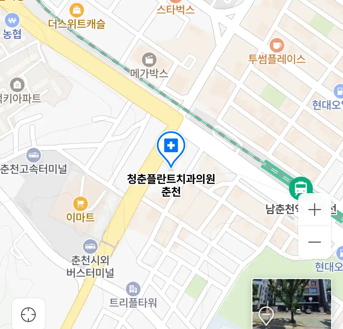 청춘플란트치과의원 춘천 위치