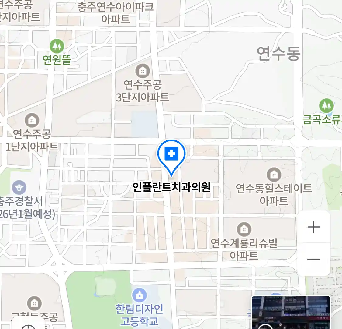 인플란트치과의원 위치