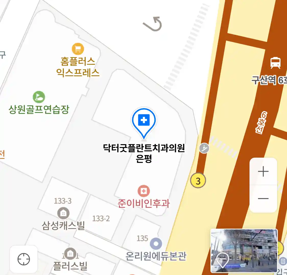 닥터굿플란트치과의원 은평 위치