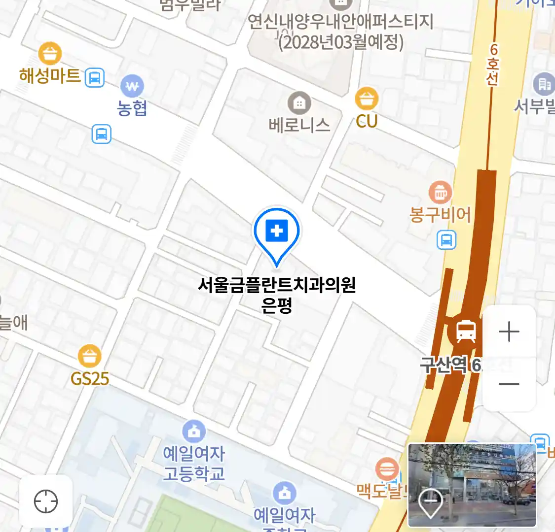 서울금플란트치과의원 은평 위치