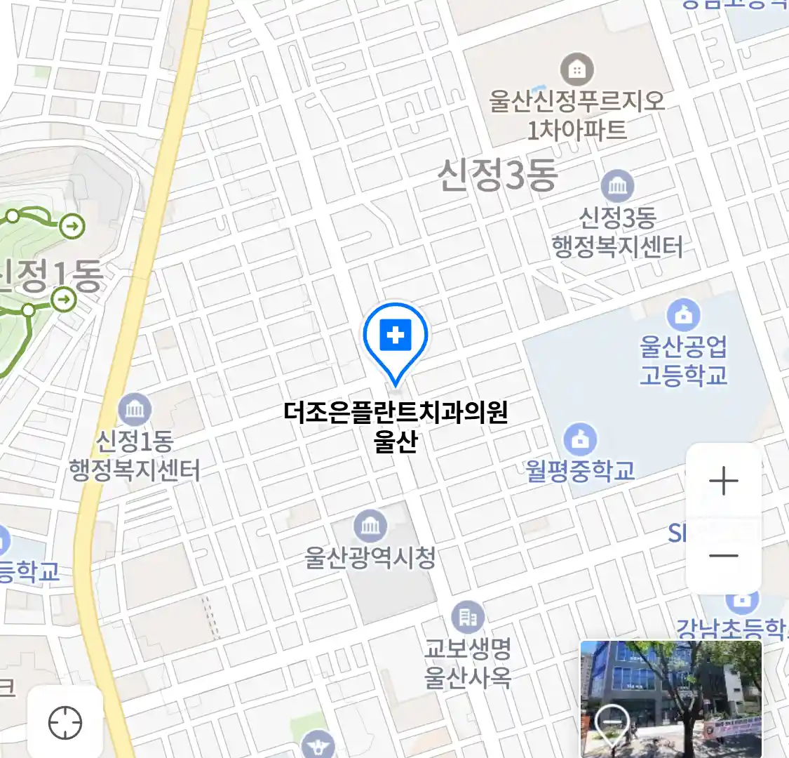 더조은플란트치과의원 울산 위치