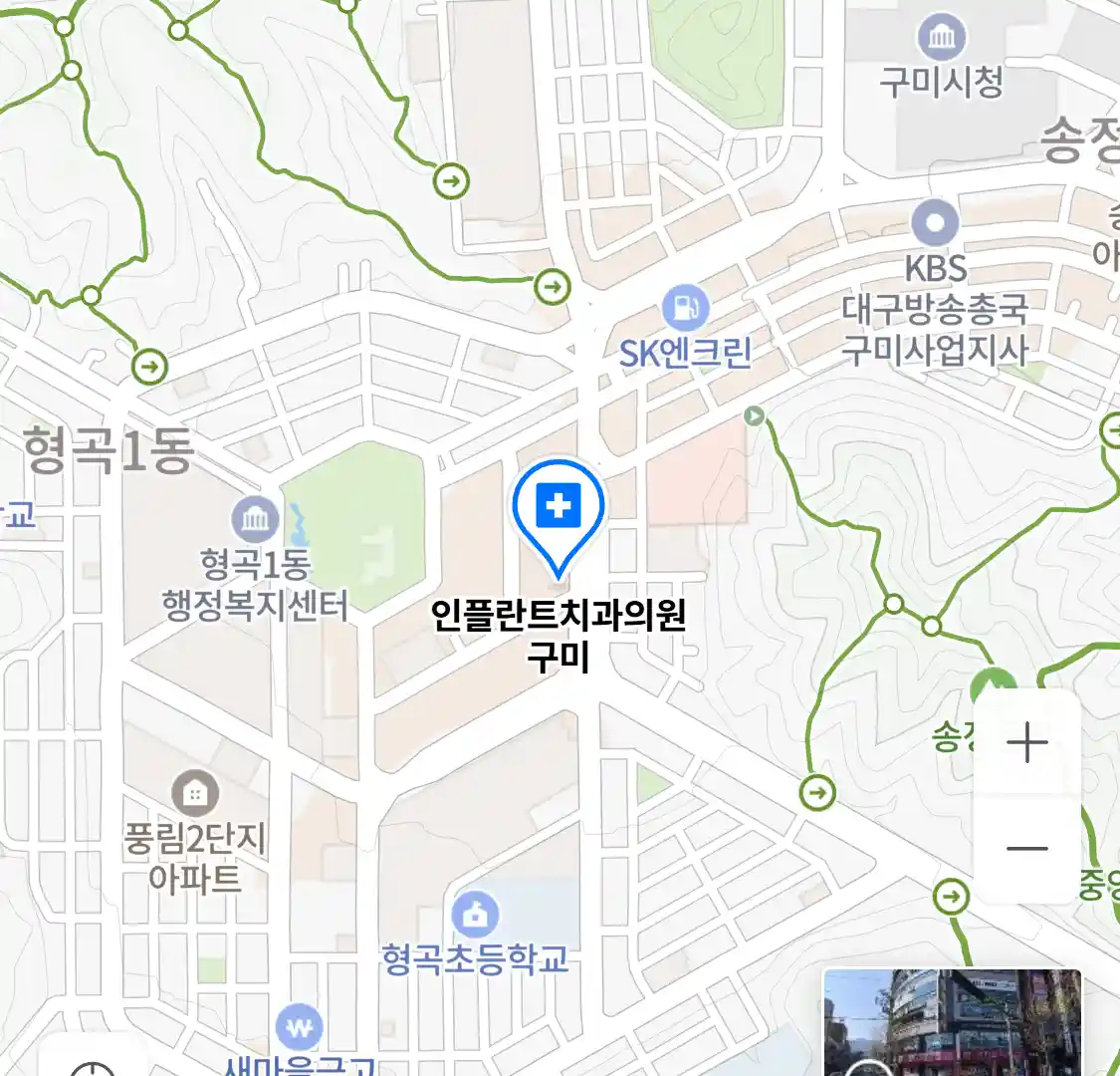 인플란트치과의원 구미 위치