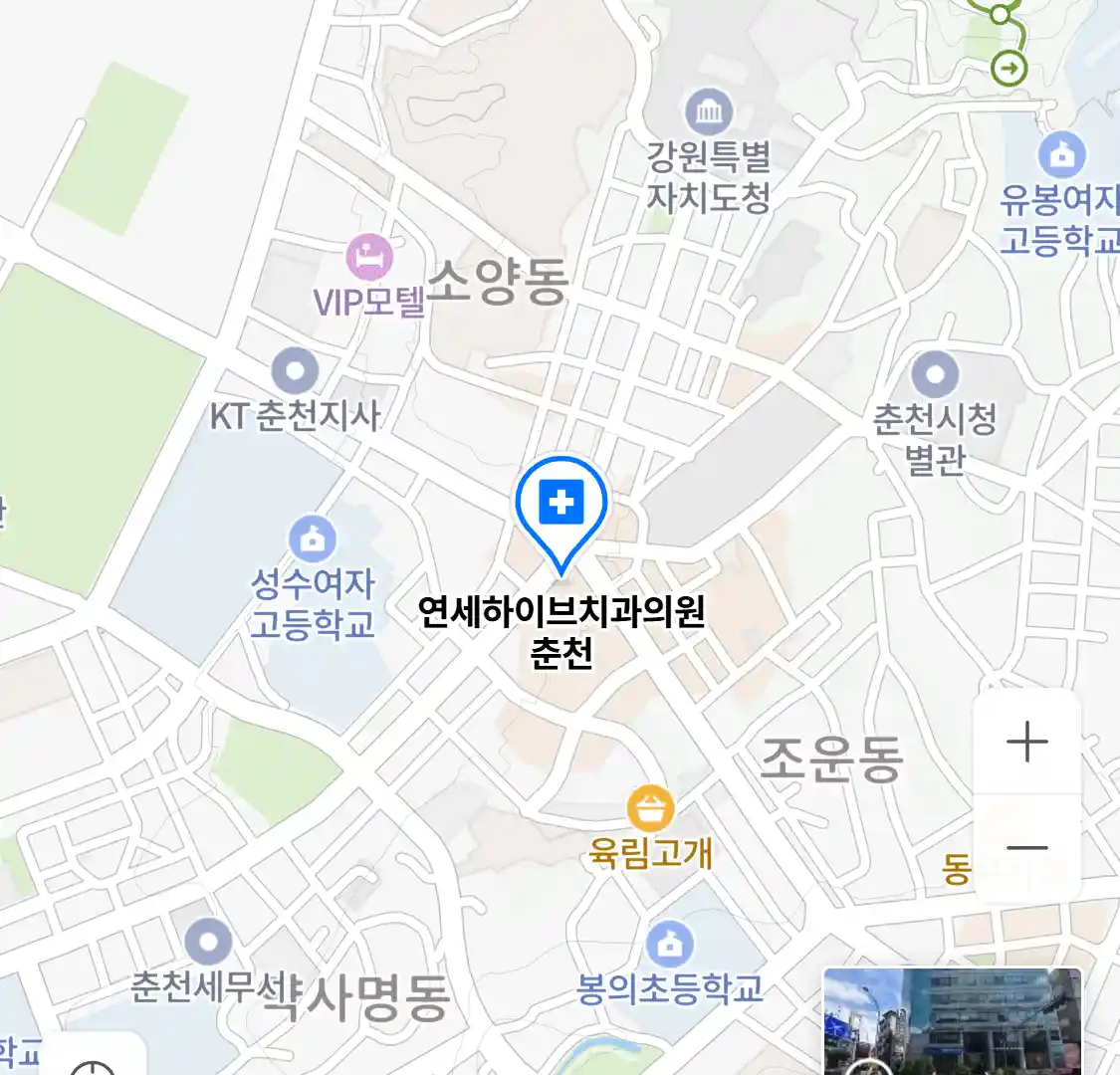 연세하이브치과의원 춘천 위치